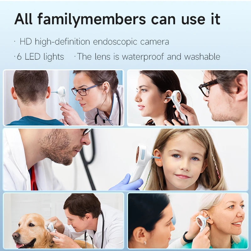 Ear Cleaner 1.8’’ Screen Ear Camera  Instant On/Record, Home & Pet Otoscope