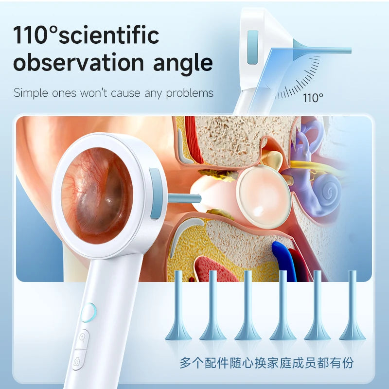 Ear Cleaner 1.8’’ Screen Ear Camera  Instant On/Record, Home & Pet Otoscope