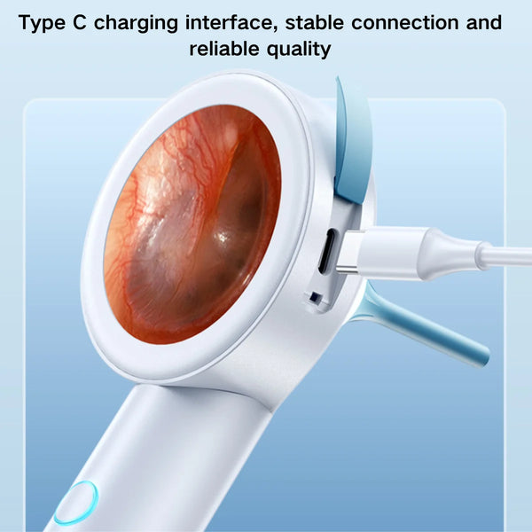 Ear Cleaner 1.8’’ Screen Ear Camera  Instant On/Record, Home & Pet Otoscope